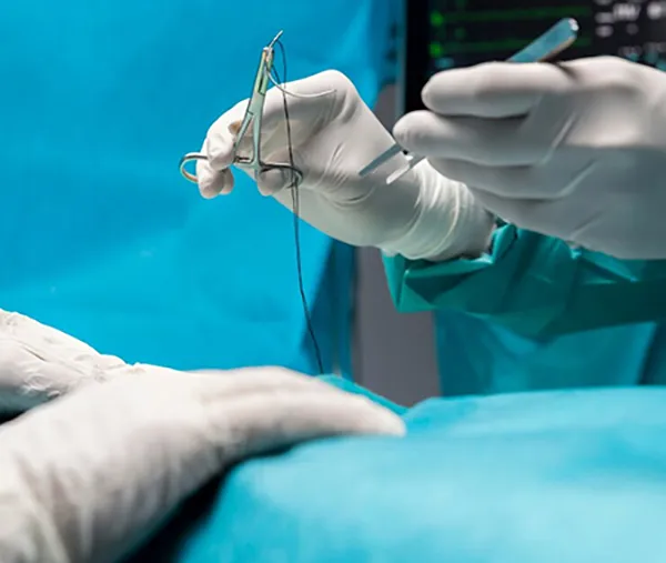 
منتجات خياطة الجروح لجراحة الأعصاب

 Gynaecological Surgery